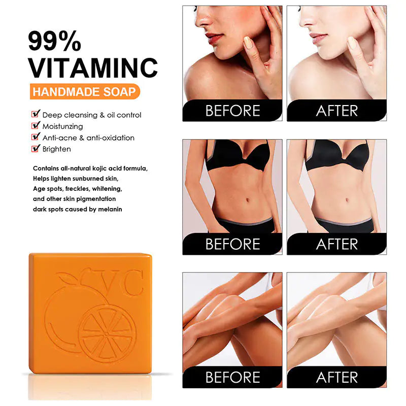 Vitamin-C Serum Whitening Soap Bar