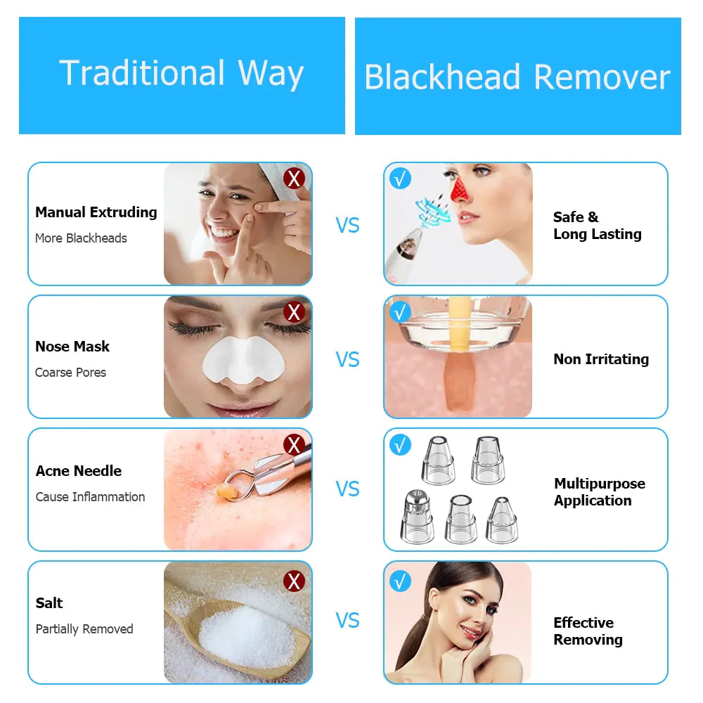 Electric Blackhead Remover Vacuum Cleane