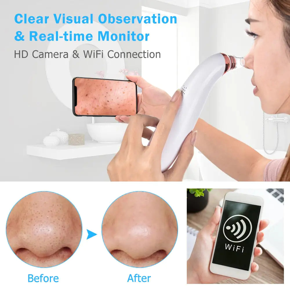 Electric Blackhead Remover Vacuum Cleane