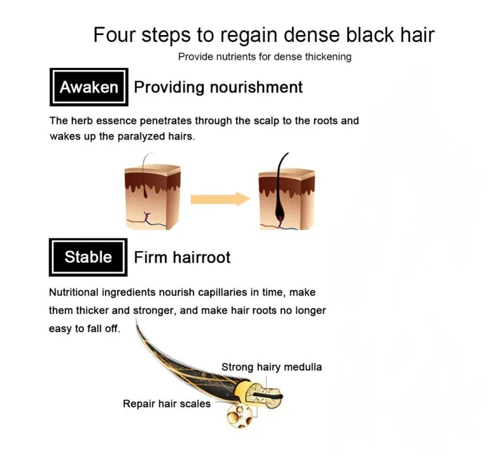 Follicle Stimulating