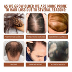 Infographic on hair loss causes with images and text