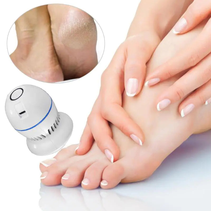 Portable Vacuum Callus Remover